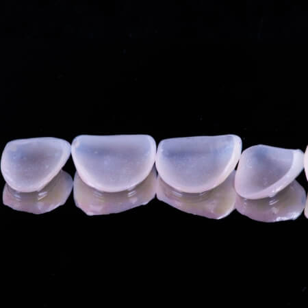Row of metal free dental restorations prior to placement